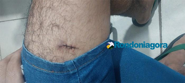 Casal é preso após briga com agressões e facadas no Porto Madeiro III