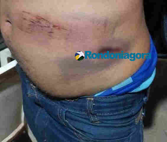 Ataque em família: homem é brutalmente espancado e perseguido por sobrinhos da esposa