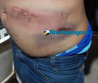 Ataque em família: homem é brutalmente espancado e perseguido por sobrinhos da esposa