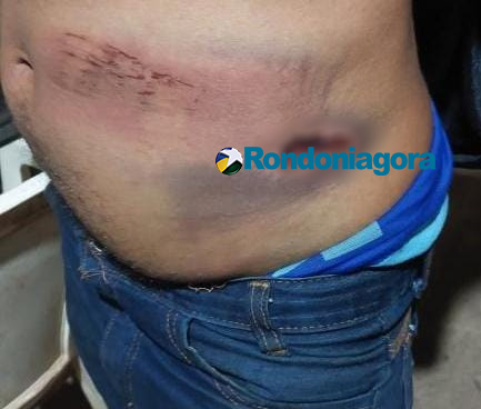 Ataque em família: homem é brutalmente espancado e perseguido por sobrinhos da esposa