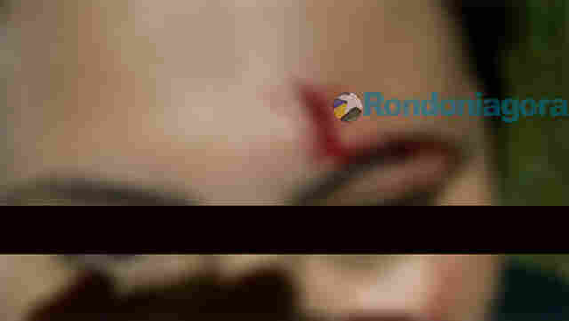 Mulher &eacute; presa ap&oacute;s atacar cunhada com facada no rosto na capital