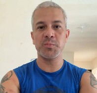 V&iacute;deo: servidor do Detran revela nas redes sociais que foi infectado por Mpox em Porto Velho