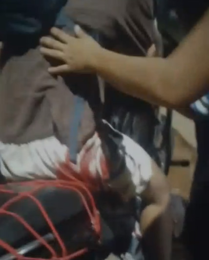 Bandido sai da mata e abre fogo contra trabalhador em Porto Velho