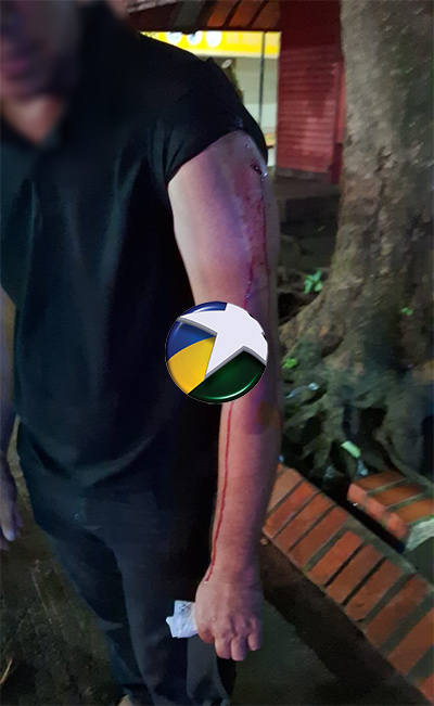 Criminoso tenta roubar celular em parada de ônibus, esfaqueia vítima e foge