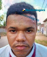 Jovem morre na UPA ap&oacute;s ser baleado no pesco&ccedil;o e na perna na capital