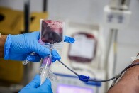 Fhemeron publica na segunda-feira edital de processo seletivo com vagas para diversas &aacute;reas da sa&uacute;de em Rond&ocirc;nia