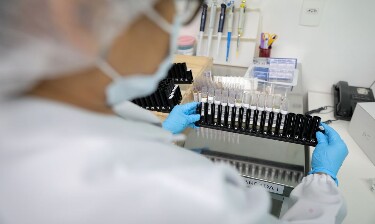 Mal&aacute;ria: Anvisa autoriza teste em humanos de vacina 100% brasileira

